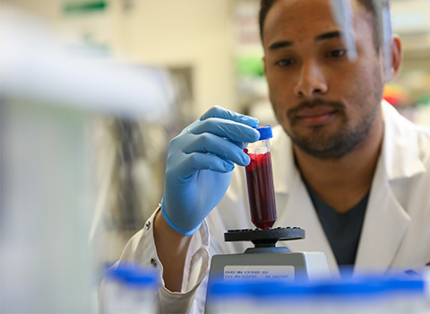 A scientist observes a patient sample in the lab